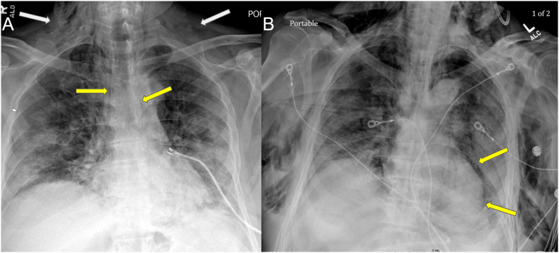 Fig. 7