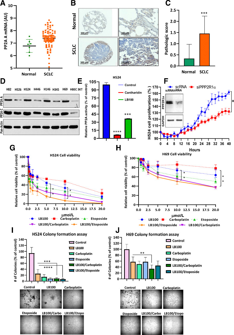 Figure 1. PP2A A expression in SCLC tumors and cells, effect LB100. A, Scatter plot shows an upregulation of the PP2A-A subunit in the tumor samples (P = 0.0144). A Mann–Whitney U test was used for comparison between the normal and SCLC samples. B, IHC for PP2A was conducted on TMA tissue sections, and images were captured at 4× or 20× using a 3D-Histech PANNORAMIC SCAN whole slide scanner (3D-Histech). PP2A subunit A positively immunostained the cytoplasm and nucleus of normal lung and tumor tissue but was highly upregulated in tumor tissue. TMAs were scored in normal (n = 24) and tumor (n = 79) cores on a scale from 0 (no staining/no protein expression) to 3+ (strong staining/high protein expression). C, Summary bar graph of the average PP2A subunit staining. IHC staining intensity of normal and tumor cores. There was a statistically significant difference between normal and tumor tissue (***, P < 0.001). Student t test was used for comparison between the normal and SCLC samples. D, To compare the expression of PP2A subunits A and C, cell lysates from seven SCLC cell lines and HBEC 3KT (nonmalignant cell line) were subjected to Western blotting (n = 3 biological replicates). E, PP2A activity was determined using a serine/threonine phosphatase activity assay (Millipore) after 24 hours exposure to cantharidin (10 μmol/L) and LB100 (5 μmol/L; n = 3 biological replicates).***, P < 0.001, results were analyzed by ANOVA with Tukey post-test. F, The inset showed reduction of PP2A subunit Aα in H524 cells as well as inhibition of cell proliferation due to PP2A subunit Aα knockdown (n = 3 biological replicates). P < 0.05, Student t test was used for comparison between the groups. LB100 alone or in combination with carboplatin inhibited proliferation and colony formation in SCLC cells. The Cell Counting Kit-8 assay detected cell H524 and H69 cell viability. (n = 3 biological replicates). G and H, Cells were treated with LB100, carboplatin and etoposide, as a single treatment or in combination, at constant ratio. The CI was calculated using Chou-Talalay method to find synergism between LB100 with carboplatin and etoposide (CompuSyn software: www.combosyn.com). **, P < 0.01, ANOVA with Tukey post test was used for comparison between LB100, LB100/carboplatin, and LB100/etoposide. Colony formation assays were used to count the ability of H524 (I) and H69 (J) cells to form colonies. Drug concentrations are listed for two assays with H524 and H69, respectively: LB100 (2.5 μmol/L; 20 μmol/L), carboplatin (4 μmol/L; 20 μmol/L), etoposide (3 μmol/L; 30 μmol/L), LB100/carboplatin (2.5 and 4 μmol/L; 20 and 20 μmol/L), and LB100/etoposide (2.5 and 3 μmol/L; 20 and 30 μmol/L). Representative images of colonies at 4× are shown under the graph (n = 2). *, P < 0.05; **, P < 0.01; ***, P < 0.001; ****, P < 0.0001. Results were analyzed by ANOVA with Tukey post test.