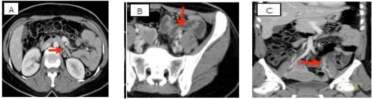 Fig. 2