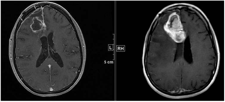 Fig. 5