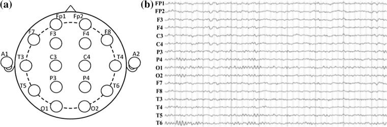 Fig. 1