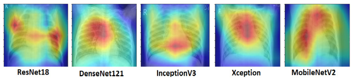 Figure 12