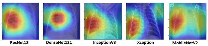 Figure 11