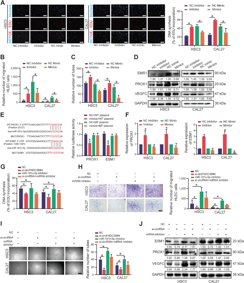 Figure 7. circFNDC3B promotes lymphangiogenesis via the miR‑181c‑5p/PROX1 axis in OSCC. A–C, The conditioned medium from miR-181c-5p inhibitor OSCC cells was dramatically beneficial to the proliferation (A), migration (B), and tube formation (C) of HLECs, whereas the miR-181c-5p mimics group had the opposite results. D, The protein expression of VEGFC, PROX1, and ESM1 in HSC3 and CAL27 cells with miR-181c-5p inhibitor or mimics transfection was detected by Western blot. E, Dual luciferase reporter assays showed the luciferase activity of WT or MUT PROX1 and ESM1 following cotransfection with miR-181c-5p mimics or NC. Relative firefly luciferase expression was normalized to that of Renilla luciferase. F, The mRNA expression of PROX1 and ESM1 in HSC3 and CAL27 cells with miR-181c-5p inhibitor or mimics transfection was detected by qRT-PCR. G–I, EdU (G), transwell migration assays (H) and tube formation (I) presented that the conditioned medium from miR-181c-5p inhibitor could partially rescue proliferation, migration, and tube formation of HLEC cocultured with the conditioned medium from si-circFNDC3B, respectively. J, Western blot analysis of ESM1, PROX1, and VEGFC. Data were presented as the mean ± SEM from three independent experiments. *, Statistical significance. Scale bars, 100 μm (A, H, and I).