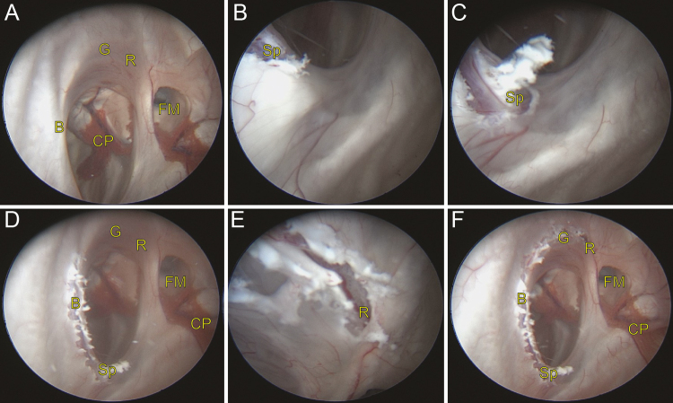 FIG. 3.