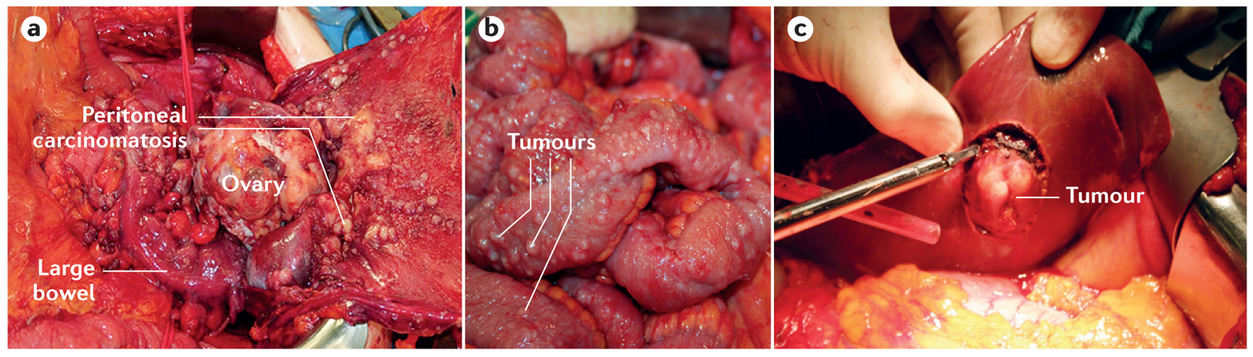 Figure 4 |