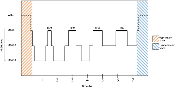 FIGURE 1