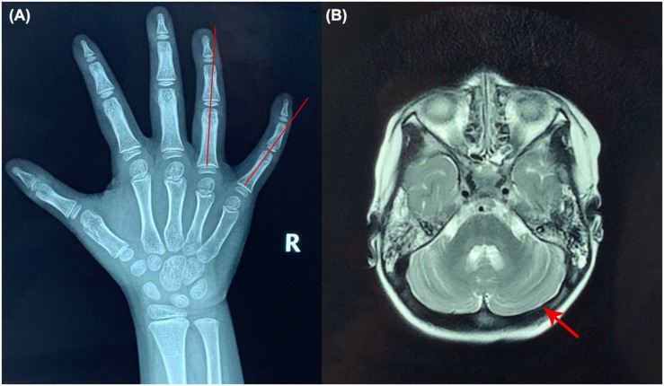 FIGURE 1