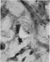 72