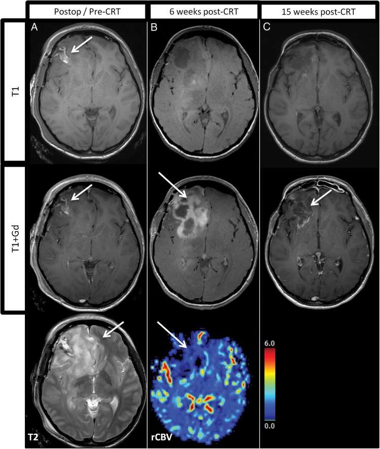 Fig. 3.