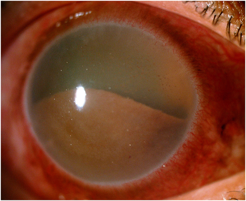 Fig. 1