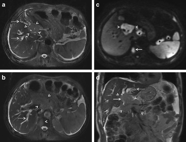 Fig. 16