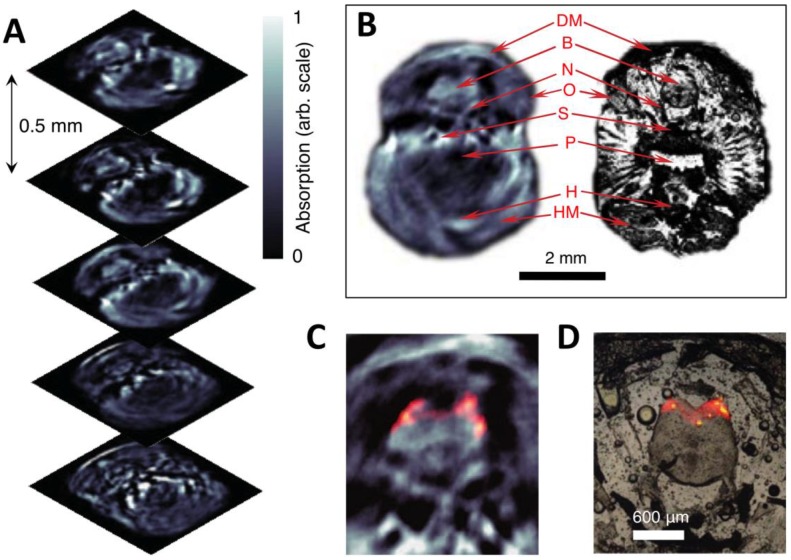 Figure 11