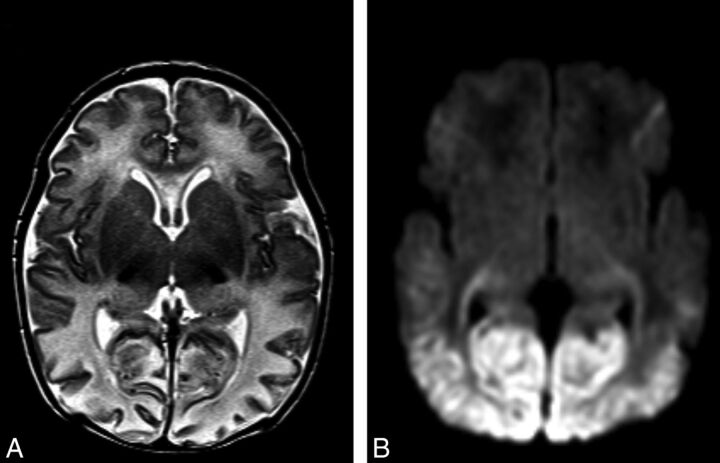 Fig 1.