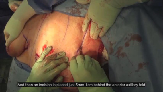 Video 2