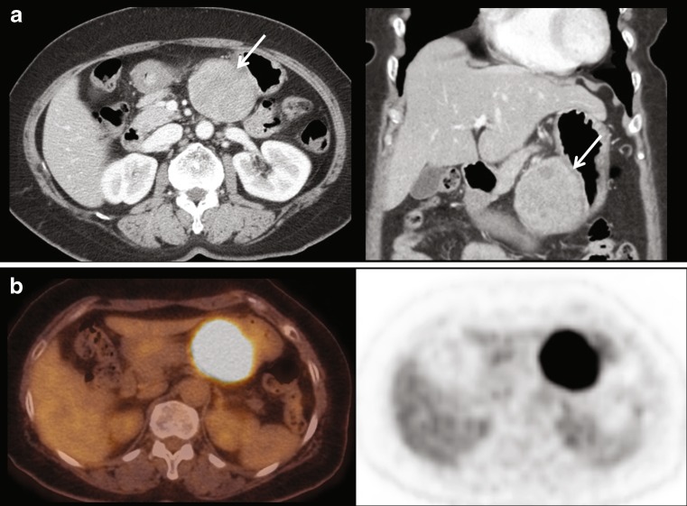 Fig. 1