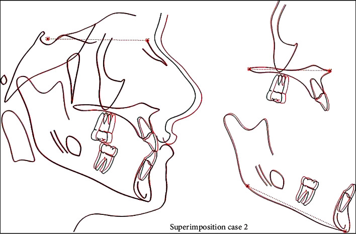 Figure 14