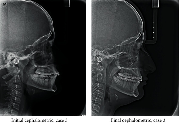 Figure 19