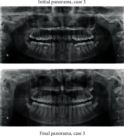 Figure 18