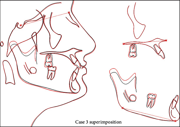 Figure 21