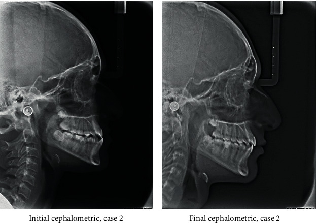 Figure 12