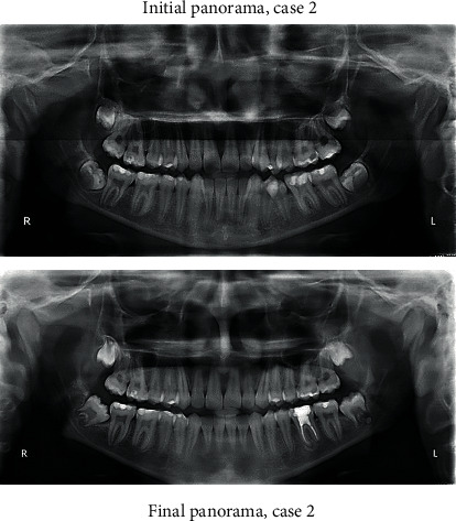 Figure 11