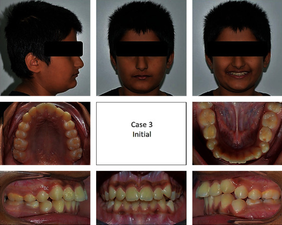 Figure 15