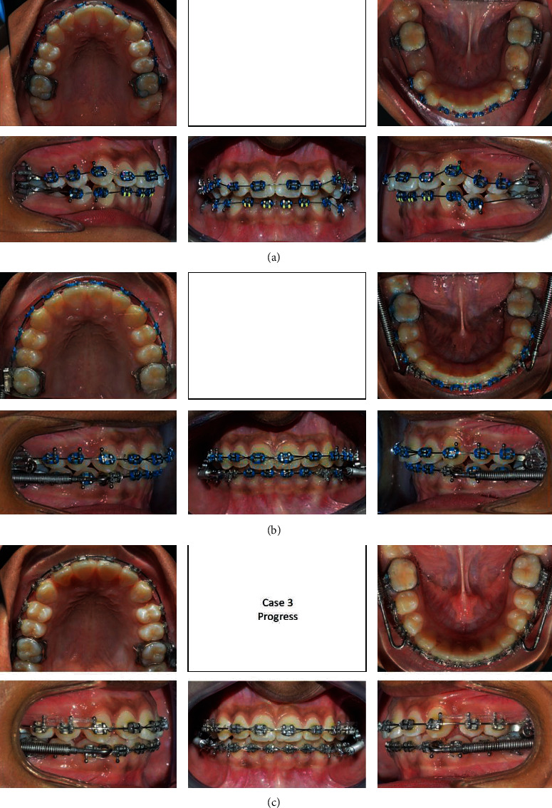 Figure 16