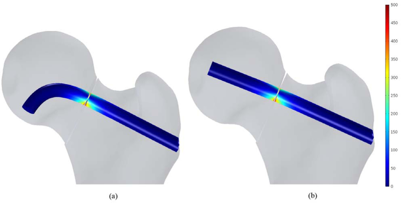 Fig. 11.