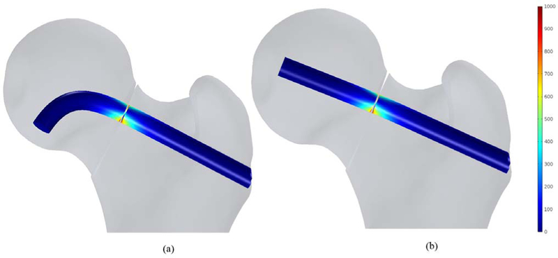 Fig. 12.