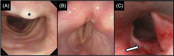 FIGURE 3