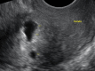 Fig. 14