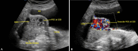 Fig. 13