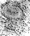 FIG. 5