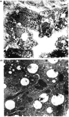 FIG. 1c,d