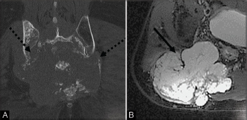 Fig. 11