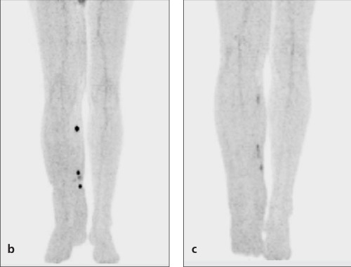 Figure 1b-c