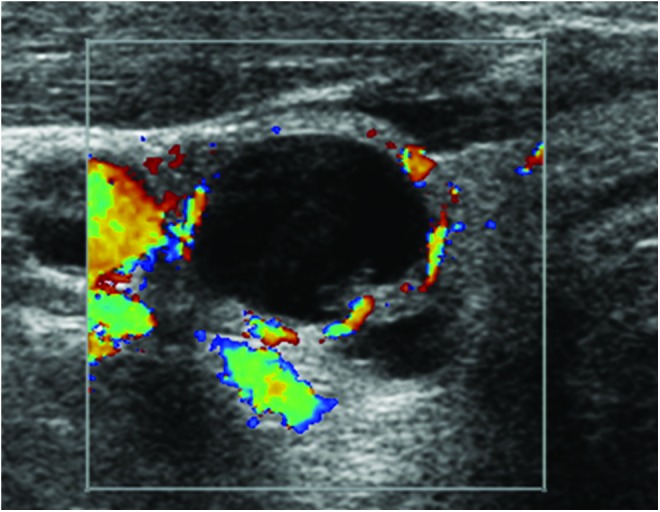 FIG. 3.