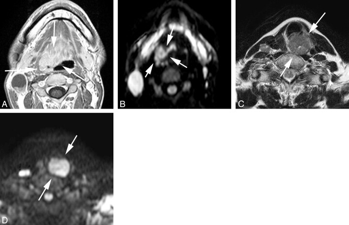 Fig 1.