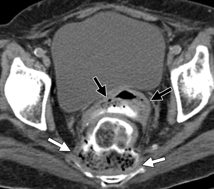 Figure 14b