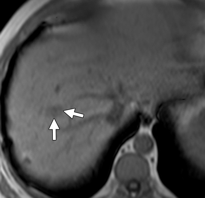 Figure 3b