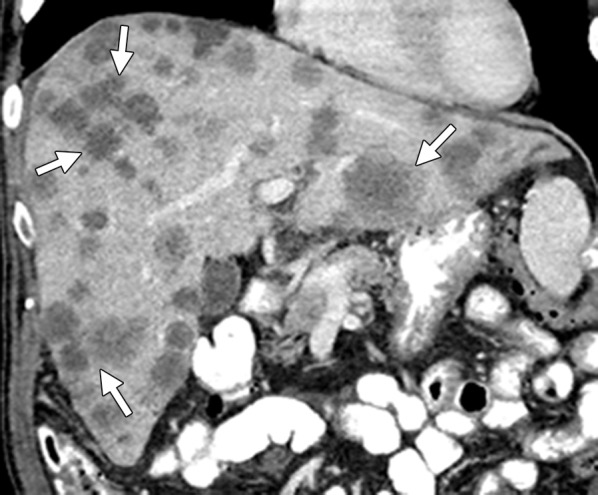 Figure 10c