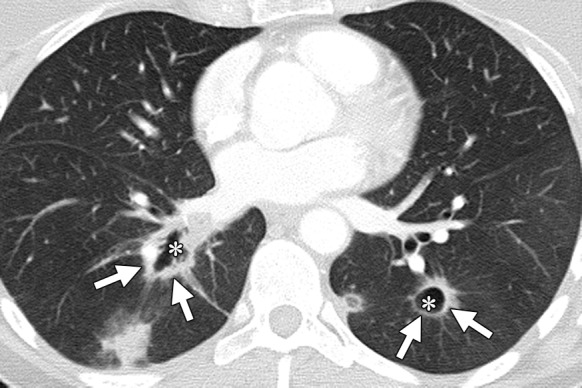 Figure 11b