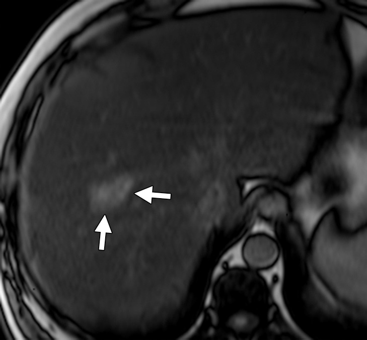 Figure 3c