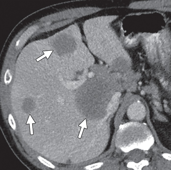 Figure 1b