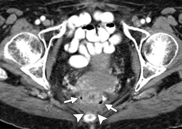 Figure 14a