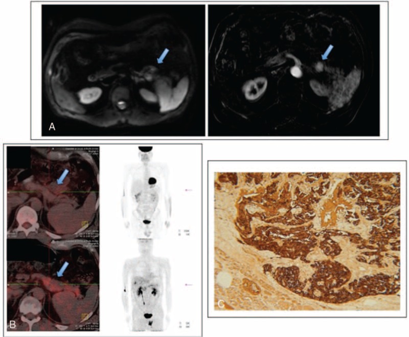 FIGURE 1