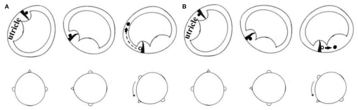 Case Report: New Application of a Gufoni Maneuver Variation for ...