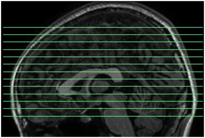 FIGURE 1