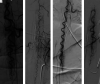 FIG 3.